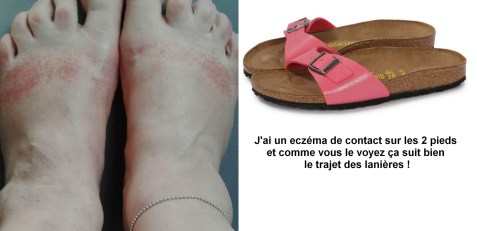 pieds
